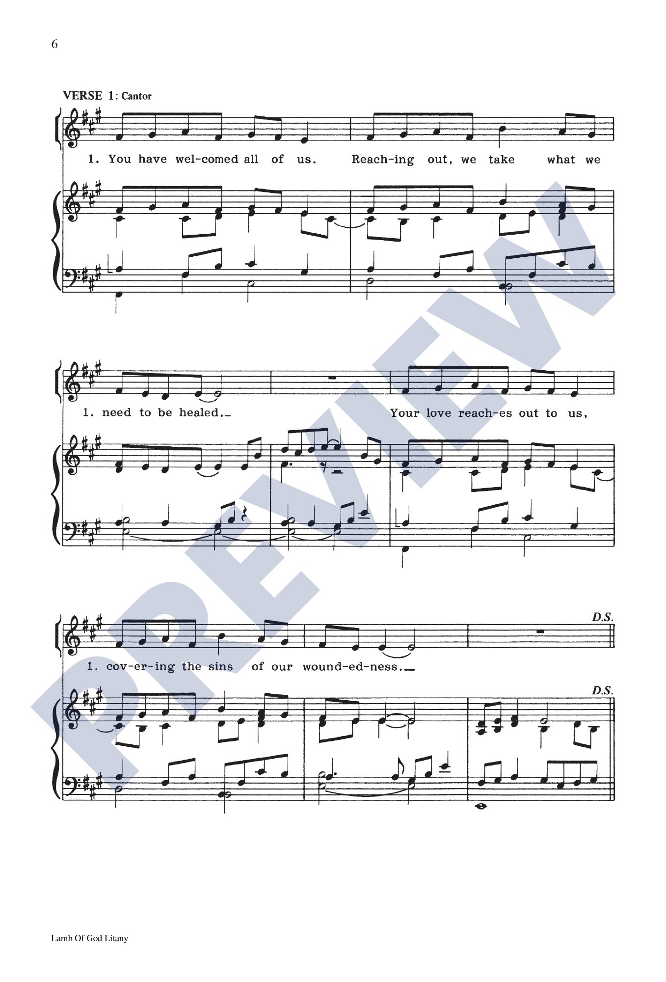 Lamb of God Litany (Communion Song of Healing)