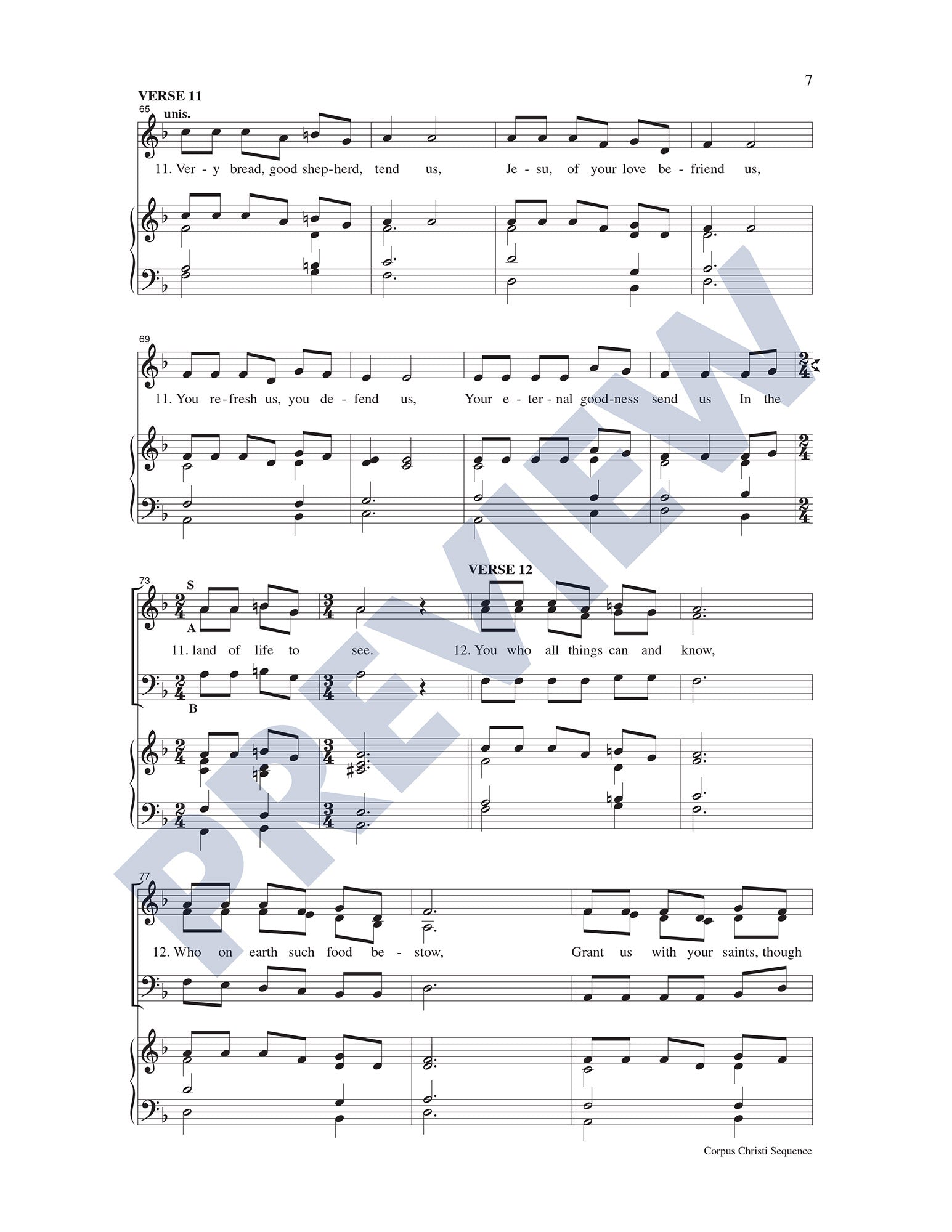 Corpus Christi Sequence